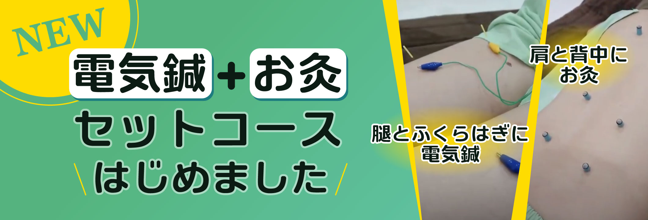 新メニュー電気鍼はじめました